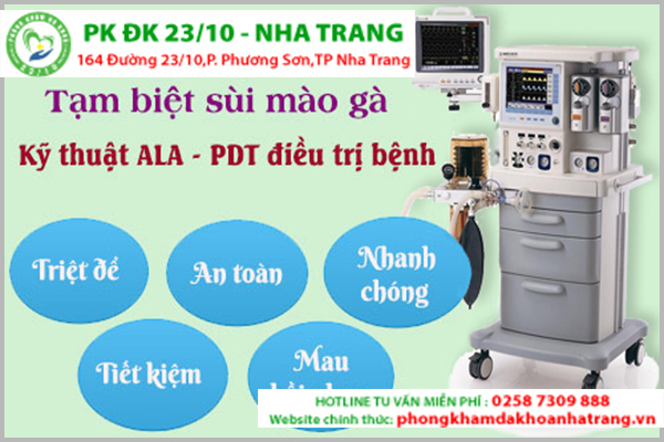 Phương pháp hỗ trợ hỗ trợ điều trị sùi mào gà hiệu quả