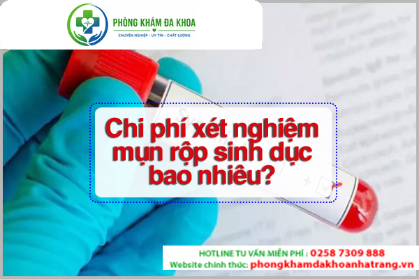 Chi phí xét nghiệm mụn rộp sinh dục ảnh hưởng bởi phương pháp thực hiện