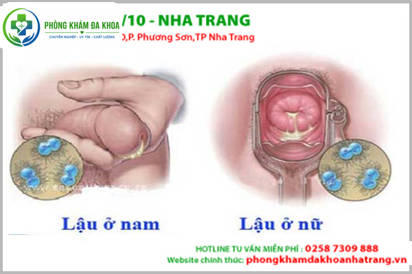 Lý giải hiện tượng tiểu buốt, tiểu rắt, tiểu ra máu