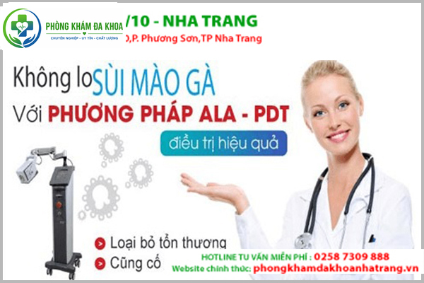  Cách hỗ trợ hỗ trợ điều trị sùi mào gà hiệu quả hiện nay