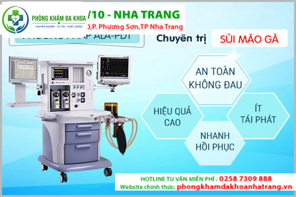 Phương pháp ALA-PDT hỗ trợ hỗ trợ điều trị sùi mào gà hiệu quả