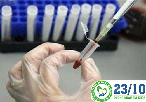 Bác sĩ sẽ chỉ định làm một số xét nghiệm để chẩn đoán bệnh.