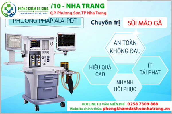 Phương pháp ALA-PDT chuyên hỗ trợ điều trị bệnh sùi mào gà hiệu quả