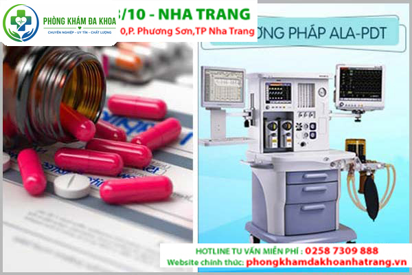 Bệnh nhân được hỗ trợ điều trị bằng thuốc khi bệnh ở giai đoạn nhẹ phuong phap dieu tri luoi noi hot