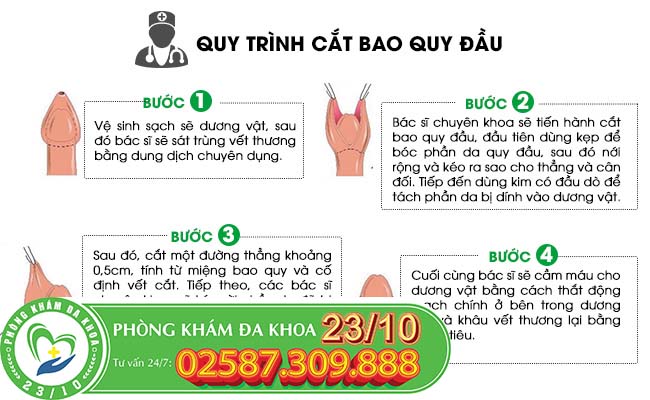 Quy trình cắt bao quy đầu bằng phương pháp xâm lấn tối thiểu