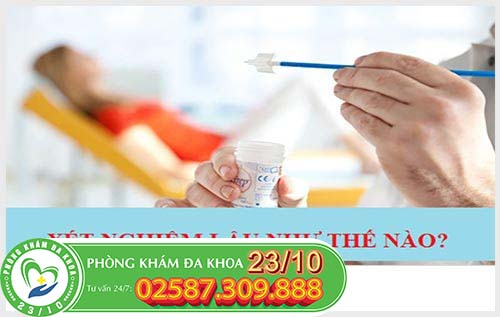 Xét nghiệm bệnh lậu bằng phương pháp nào?